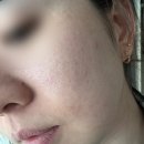 (주)메디컬오 | [올리브영 1위 모공앰플] Y자모공 교정의 비밀, 시그니처 에스투드 프로텍터 모공교정앰플 사용 후기