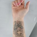 다올린의원 | 수원 문신제거 후기 더올린의원 피코레이저 8회차