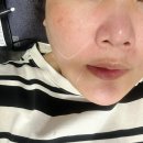 이화샘피부과의원 | [강남 피부과 FX 인모드 후기] 윤곽 관리와 탄력 케어를 동시에 받은 리얼 후기