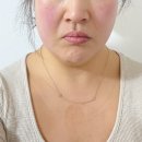 더나은에스테틱 | [춘천 퇴계동] 춘천 에스테틱 핫플! 더나은뷰티에서 받은 고주파 윤곽관리+산소테라피 후기