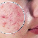 새하얀 피부과의원 이미지