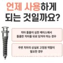 스크류비어 이미지