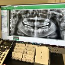 강남레옹치과의원 | [리뷰/추천] 강남레옹치과의원, 사랑니 발치가 두려운 쫄보는 보아라