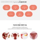 연제우리들의원 | 부산시험관후기 : 센텀이룸, 자궁내시경 수술 기록