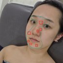 피자스쿨미아삼거리역점 | 피부과 좁쌀여드름 압출 잘하는 금손 찾았다! 미아사거리 유어에스테틱에서 모공관리 받은 리얼후기!