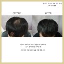 일러스라인 이미지