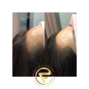 가비헤어 이미지