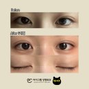 아이그램성형외과 이미지