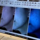 청담글래시피부과의원 이미지