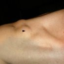 Bursa (anatomy) 이미지