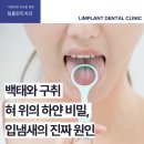 하얀플란트치과의원 이미지