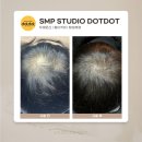 교방회원미소공인중개사사무소 | 공덕 두피문신으로 탈모 해결하기!