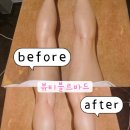 블르바드 | 뷰티블르바드 청담에스테틱 연예인 슬리밍관리 뷰티블르바드 전신관리 후기