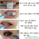 시그마덴탈 | 비바텍 덴탈시그마 360도 칫솔 사용후기 - 잇몸이 약한 아이/성인을 위한 칫솔 추천