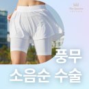 퀸즈산부인과의원 | 풍무 여의사산부인과 소음순수술, 안전하게 진행하는 방법