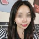 남구-18 | 포항 남구 피부관리샵 유강 에끌라뷰티 슈퍼젝션 드라마틱한 후기