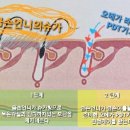 금손언니 네이버블로그