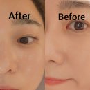 썬메디칼 | 오송웨딩관리 벨루나에스테틱 수분관리 후기