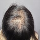 센텀모빅스피부과의원 네이버블로그