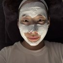 피부 요철 관리 포텐자 레이저 내돈내산 효과 통증 후기