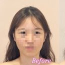 TOP순환테라피