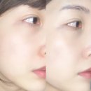 라온카케어 이미지