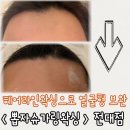 광주왁싱 커플왁싱으로도 너무 좋은 뽑자슈가링왁싱 전대에서 헤어라인 잡기