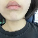 뽑고가게 | 전주 사랑니공장 이튼튼 치과 사랑니 발치후기/사랑니 뽑고 기절할뻔한썰