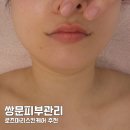 로즈마리스킨케어 쌍문역피부관리 윤곽 에스테틱 추천 후기