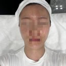 티에스(TS)메디컬 네이버블로그