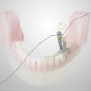 나비덴탈 이미지