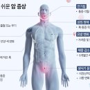 놓치기 쉬운 ‘암’ 신호 9가지 이미지