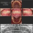 프라임에스치과교정과치과병원 이미지