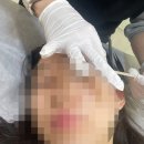 메스메디칼 | [리뷰] 오산 중요한날 피부관리는 '무모한왁싱'에서 스킨플래닝관리/오산왁싱추천/오산스킨플래닝/오산...