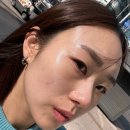 노빌헤어 | [부천원종동/반짝임왁싱부천점] 뒤집어진 피부 완벽 원상복구!!! 부천왁싱 / 원종동왁싱 / 소개팅필...