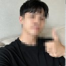 대구남성제모 젠틀맥스프로플러스 레이저제모 수염 지운 후기