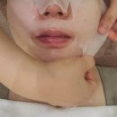 안산 에스테틱 추천 안산 피부관리 윤곽 고주파 리프팅 추천 하이푸 솔직 후기ㅣ더맑은스킨 안산중앙점