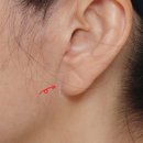 바다성형외과 | 바다성형외과 안면거상 수술 흉터 미리 보기 (실제 후기)