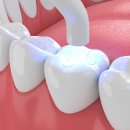 광명치과기공소 이미지