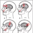 [경근필라테스] 두통 해결을 위한 필라테스 가이드: 자세 교정과 근육 이완 (1) 이미지