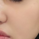 메이라뷰티 | 신대방에스테틱 주근깨 잡티 신림피부관리 지지뷰티 에서 전후사진확실 후기