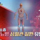 줄어드는 생존 근육을 사수하라! 이미지