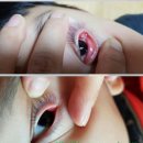 라파전위 이미지