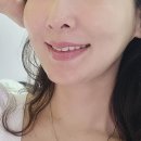 살리고 | 강남역 피부과 온다리프팅 후기 턱선 살리고 얼굴 군살 정리하기