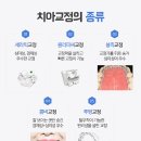울산화이트치과의원 네이버블로그