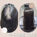 엑시스 | 의정부 고산동 미용실 엑시스살롱 모류교정 링거펌 받아본 후기