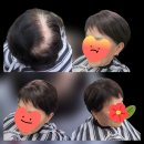 일대일미용실 & 일대일가발