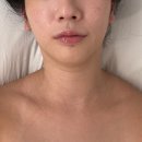 미강바이오