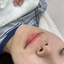 세미언니 | 부평 세미언니_입술 타투 후기_직후/일주일 후 변화
