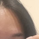 메디피엘